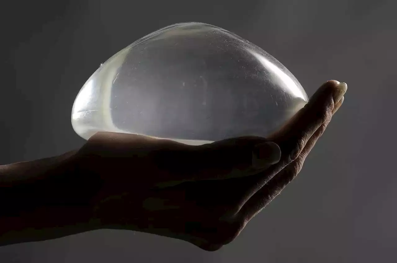 Canada’s mulling a national breast implant registry, years after a Star investigation revealed health risks