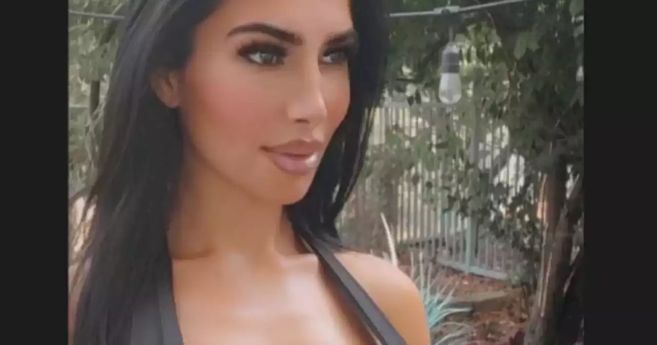 Fallece la doble de Kim Kardashian tras realizarse un procedimiento estético