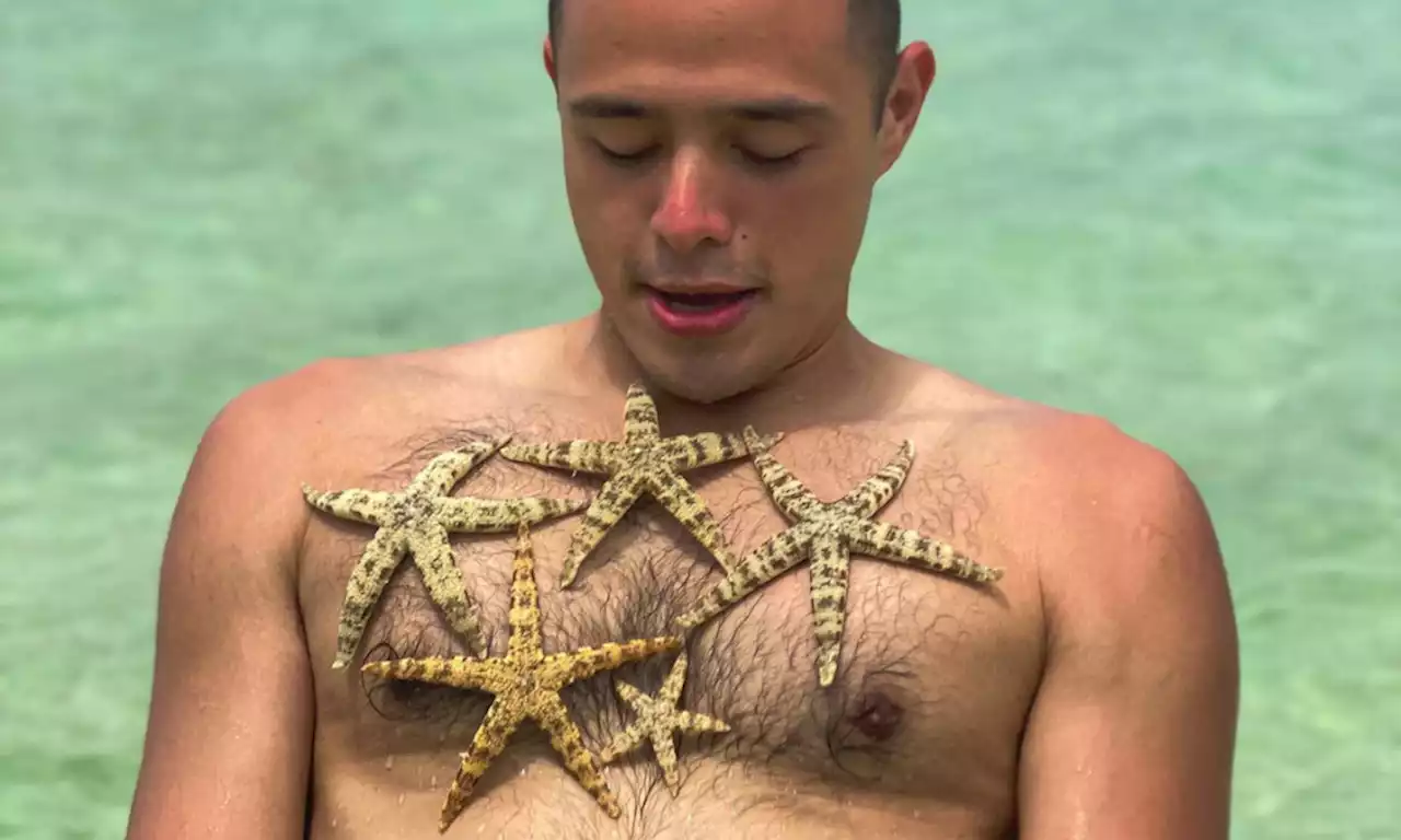 Martin del Rosario clarifies 'starfish incident'