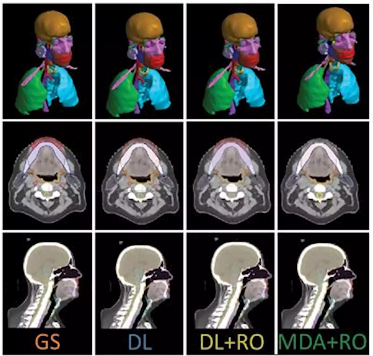 Frontiers | Validation of clinical acceptability of deep-learning-based automated segmentation of organs-at-risk for head-and-neck radiotherapy treatment planning