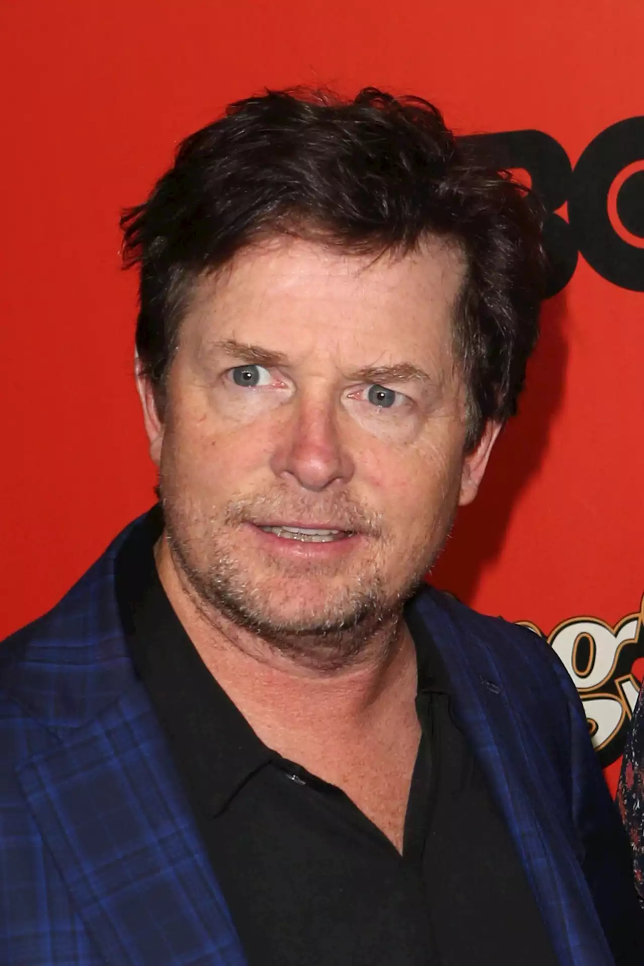 Michael J. Fox Reflects On Life With Parkinson’s: “I’m Not Going To Be 80”