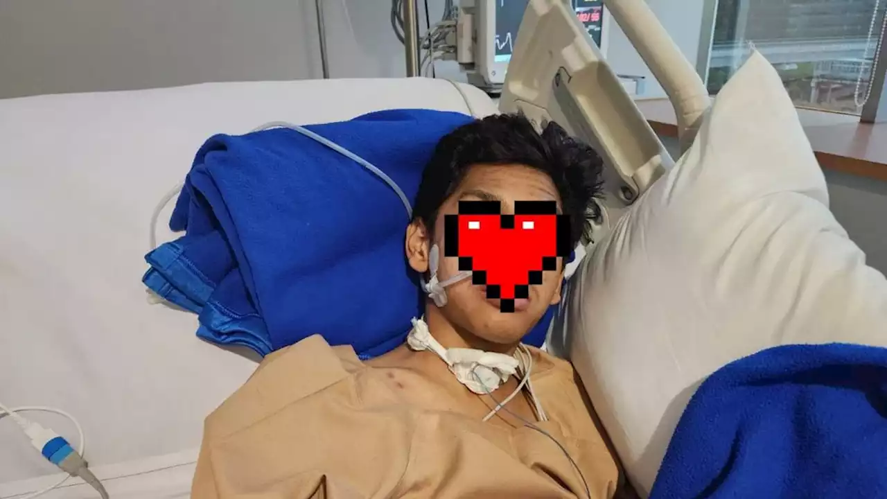 Penganiayaan Mario Dandy Sebabkan Trauma Berat hingga Saraf Terputus, David Ozora Jalani Terapi Kesadaran