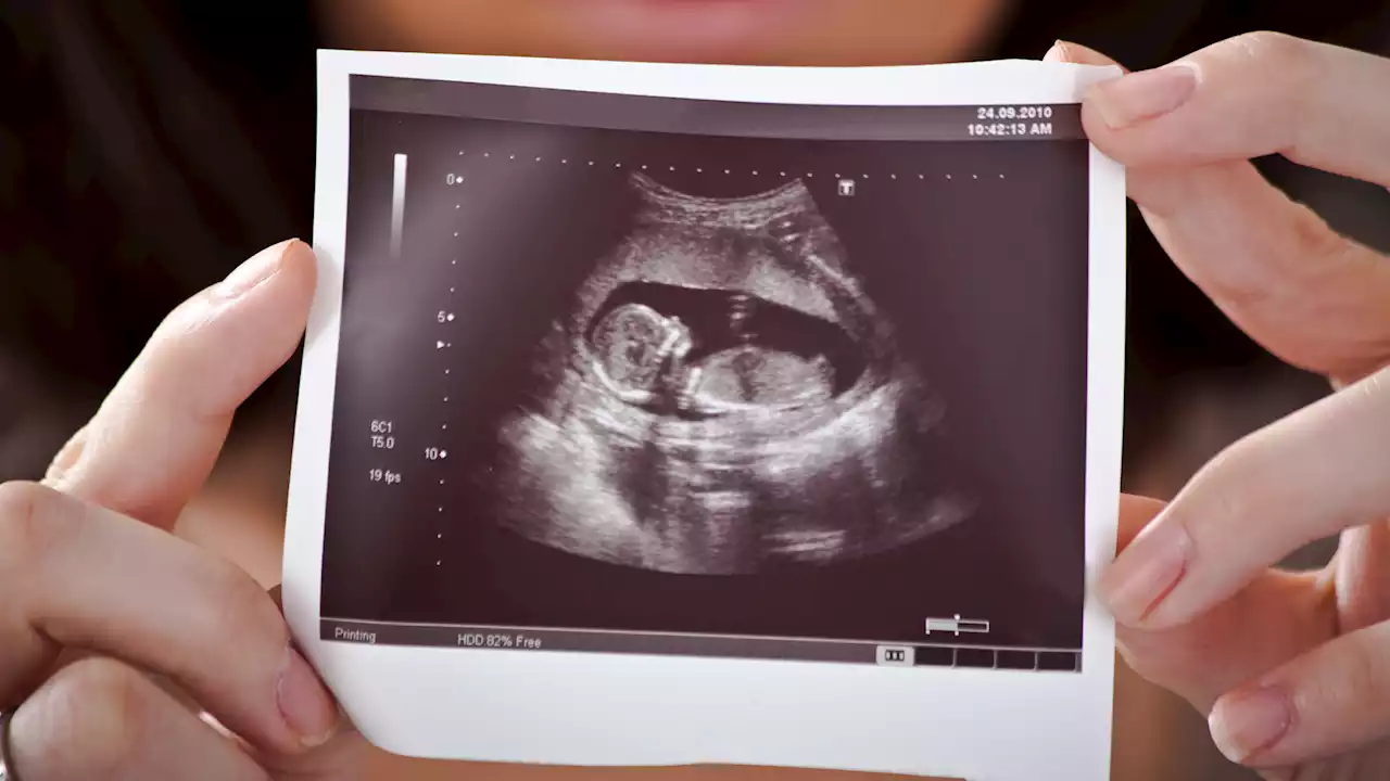 Nearly 18 percent of the global population struggles with infertility