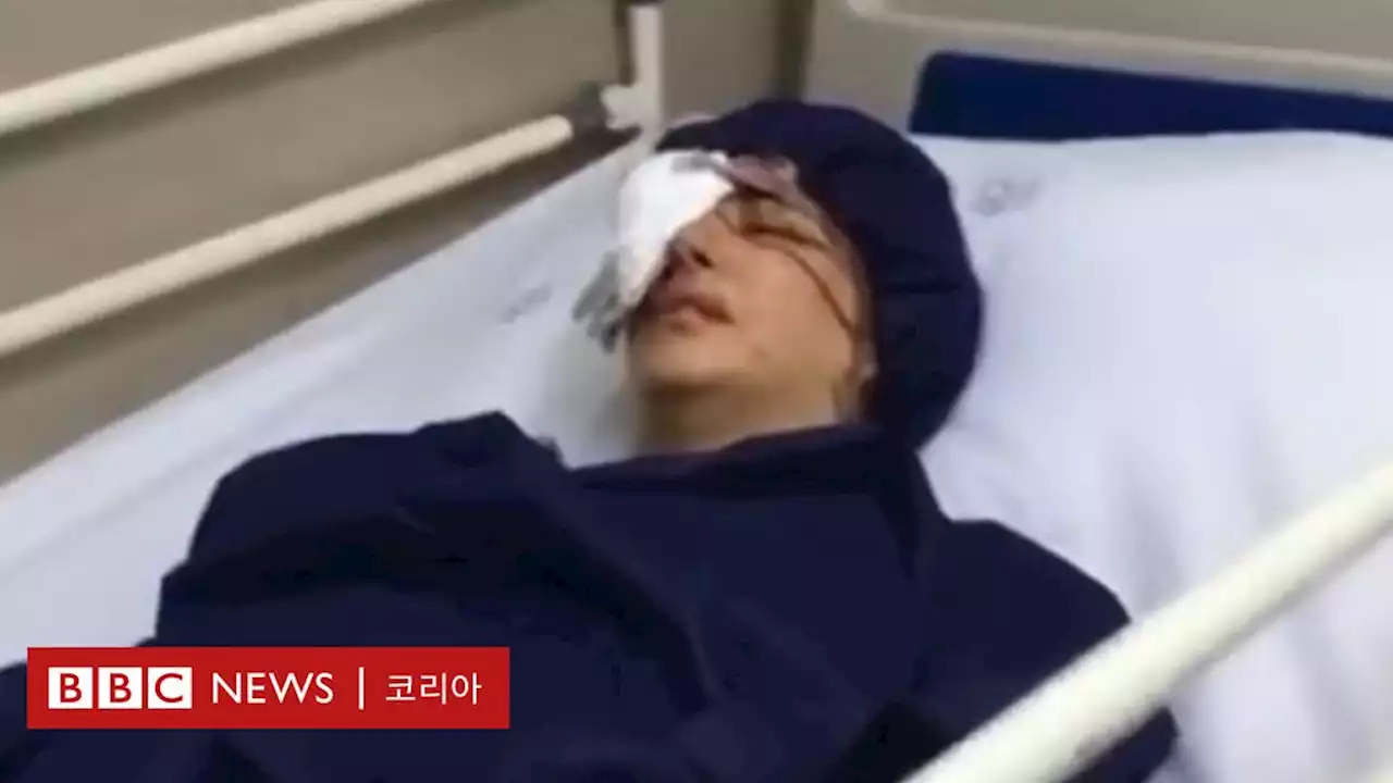 이란 시위: ‘저들은 제 눈을 앗아갔지만 제 심장은 여전히 뛰고 있습니다’ - BBC News 코리아