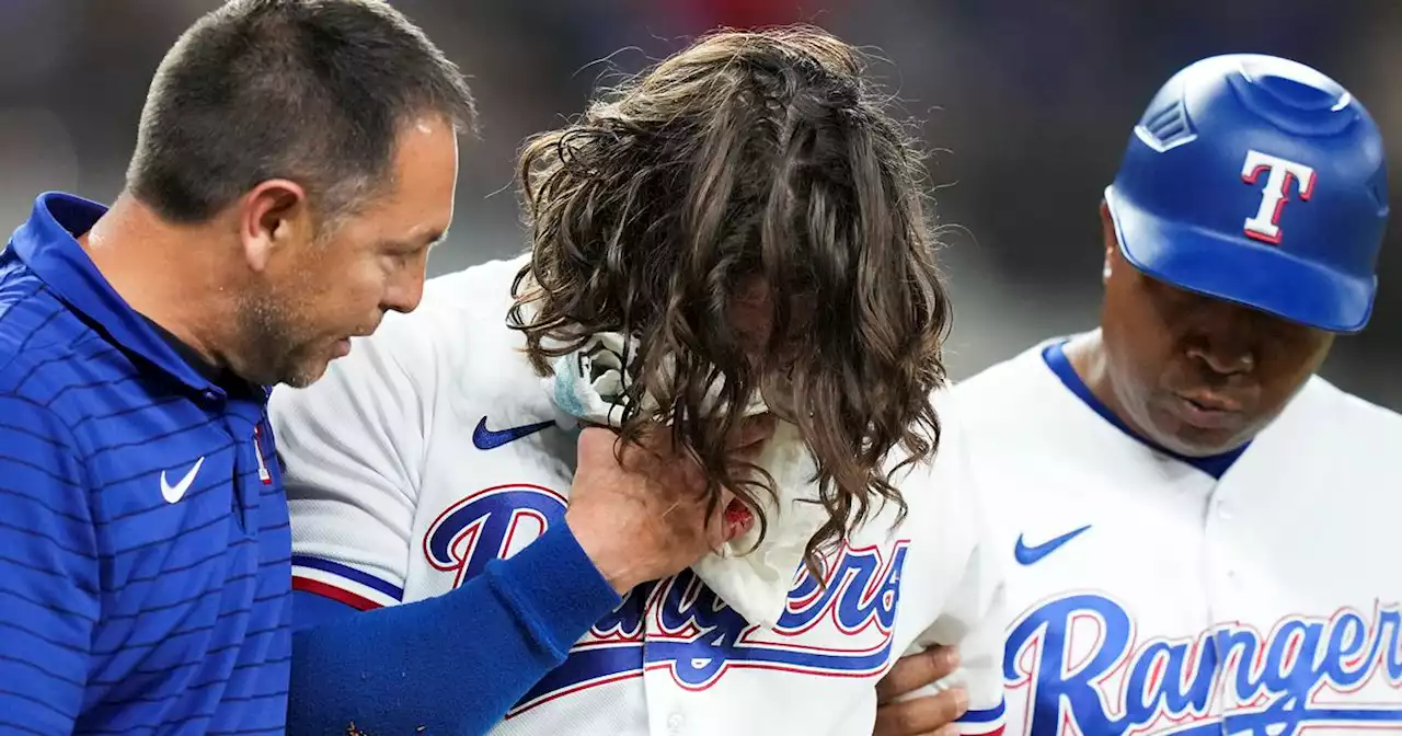 Rangers OF Josh Smith gives positive update following scary hit-by-pitch vs. Baltimore