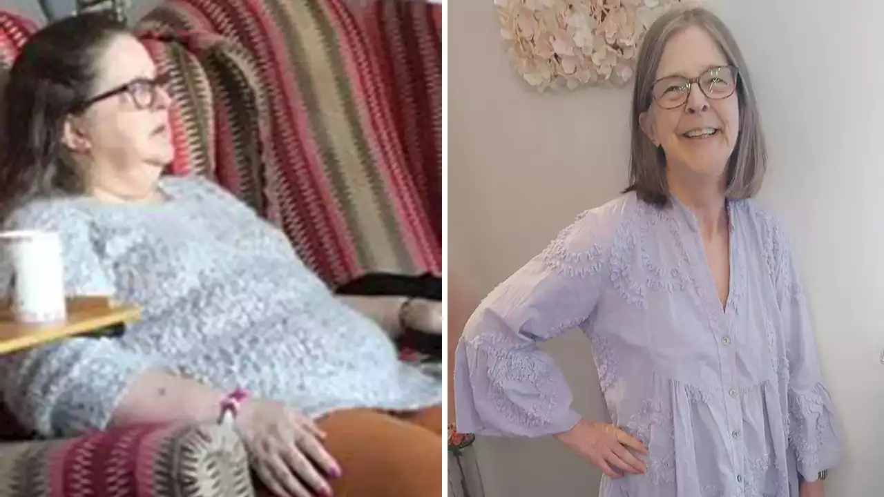 Weight loss triumph: British woman, 'embarrassed' by sight of herself, loses about 140 pounds