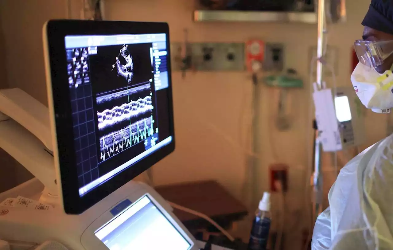 AI better than humans at key heart test —study