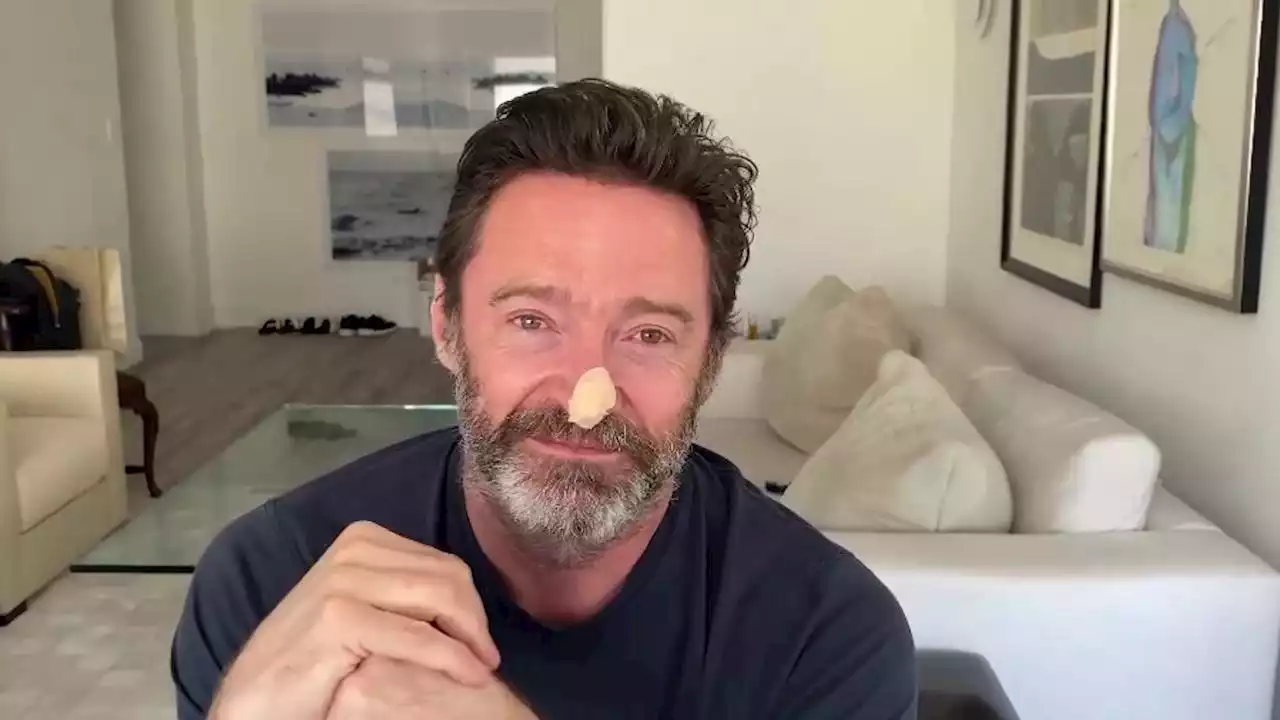 Paura per Hugh Jackman, biopsia alla pelle e rischio nuovo tumore: 'Mettete la crema solare'