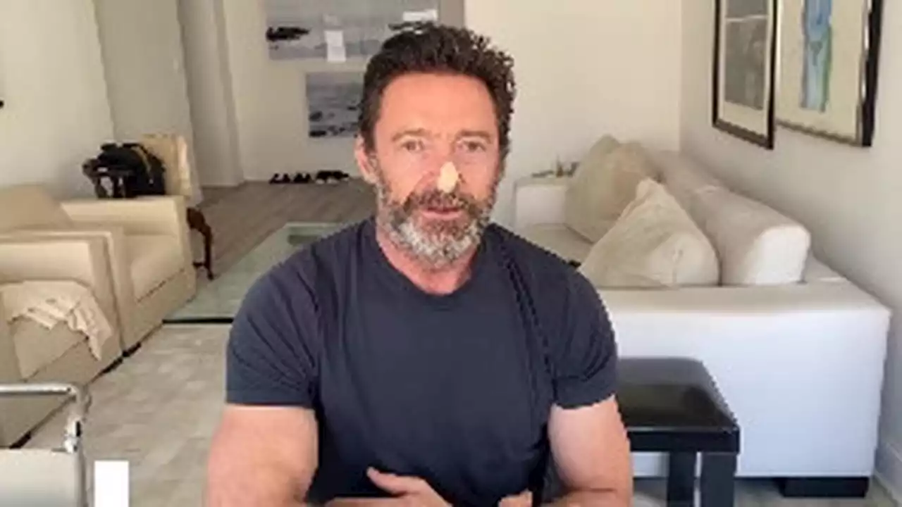 Cerita Hugh Jackman Hadapi Kanker Kulit, Beri Pesan Pentingnya Pakai Sunscreen