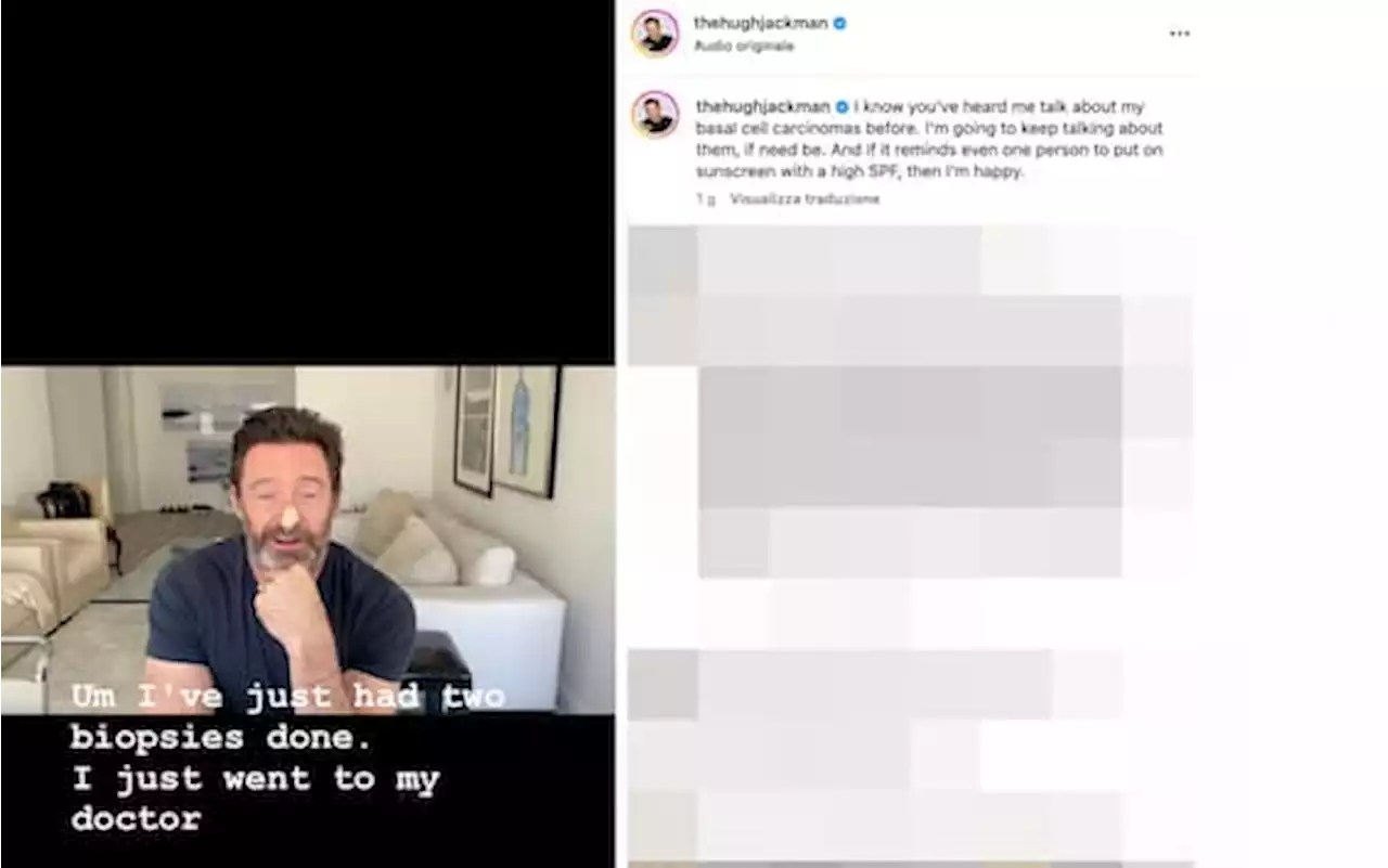 Hugh Jackman torna a parlare di tumori alla pelle: “Proteggetevi”