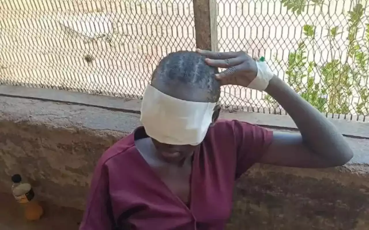 جنوب السودان: شرطي يقتلع عيني ابنته بيديه