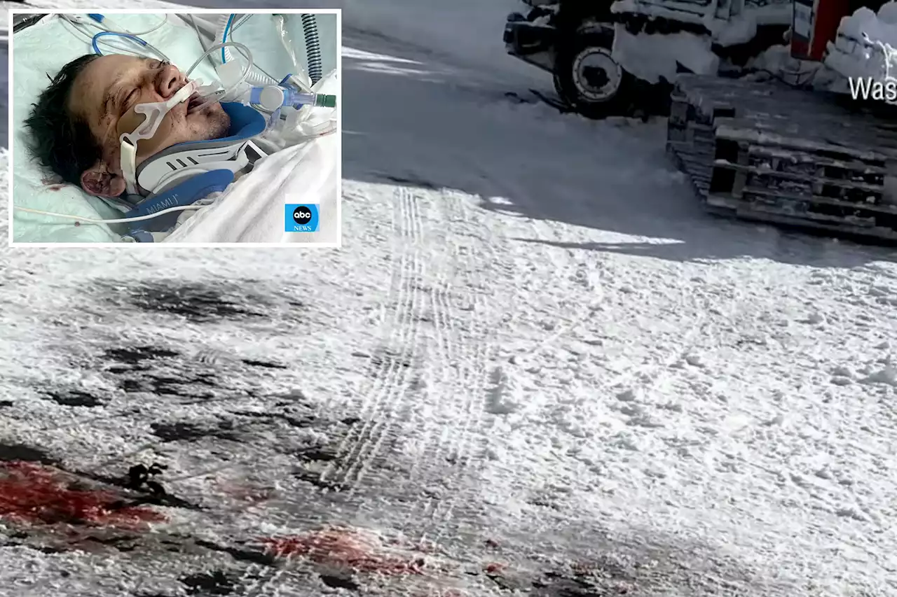 Jeremy Renner’s snowplow accident photos shown for first time on ‘GMA’