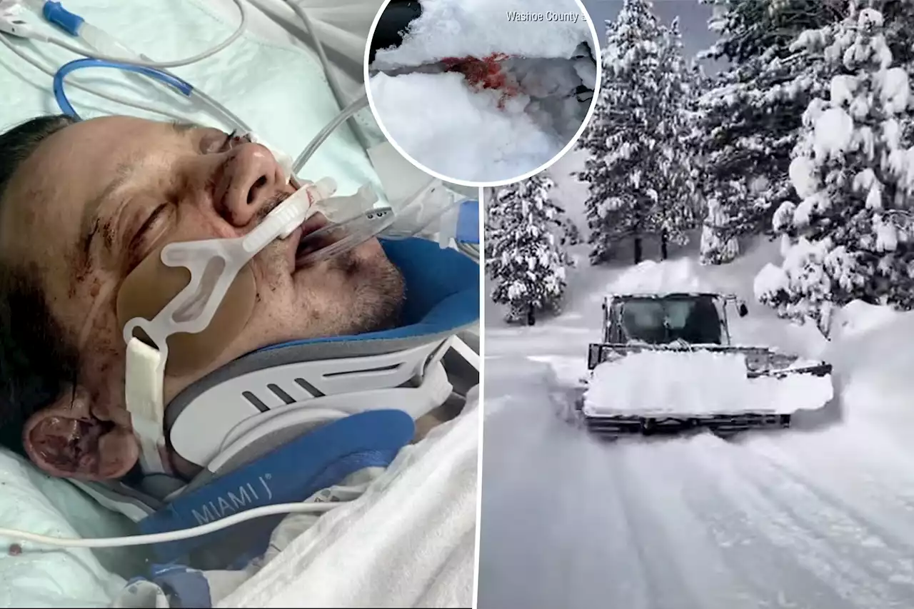 See photos of Jeremy Renner’s blood-filled snowplow accident