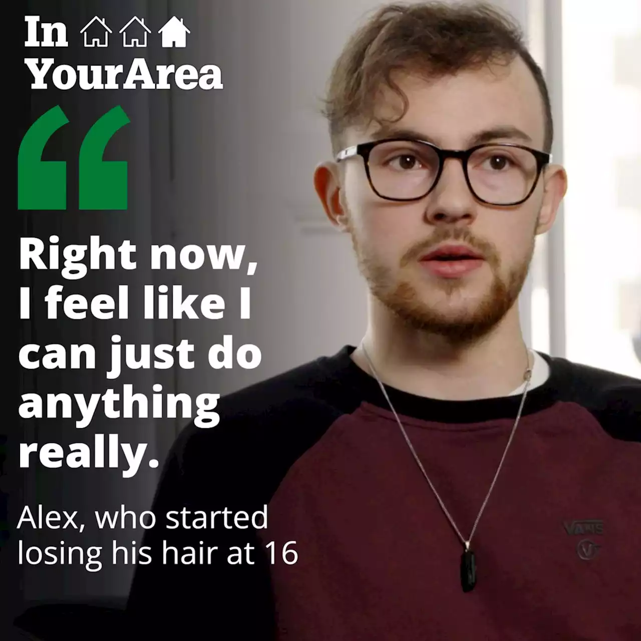 Hair transplant restores confidence of young student