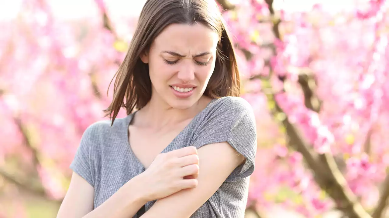 Vous êtes peut-être allergique au pollen sans le savoir