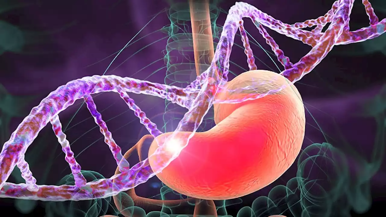 Genetic Analysis Links GERD to IPF