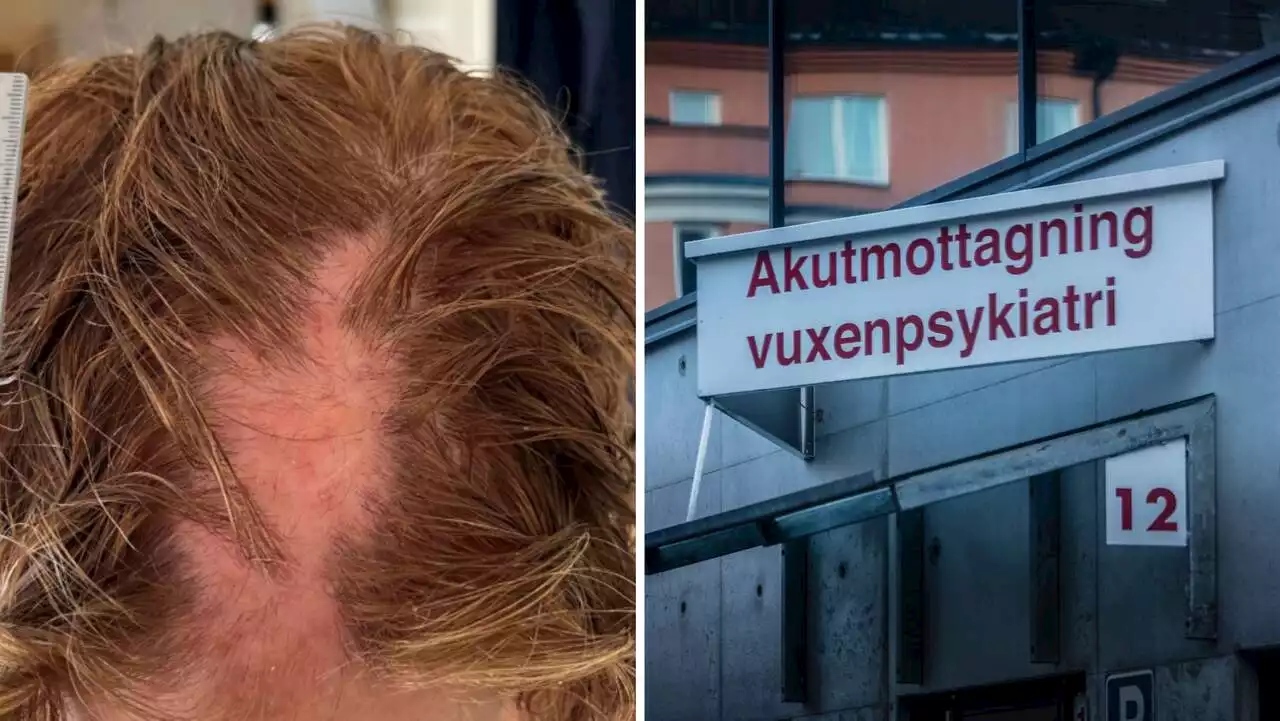 Patienten gick till attack – slet av håret på läkare