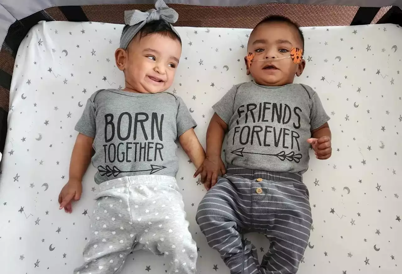 Record-breaking twins born four months early defy odds: ‘God was in control’