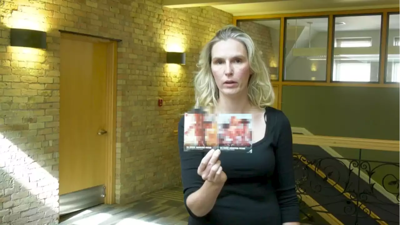 Flyers showing graphic images of fetuses subject to new safeguards under Calgary bylaw amendment