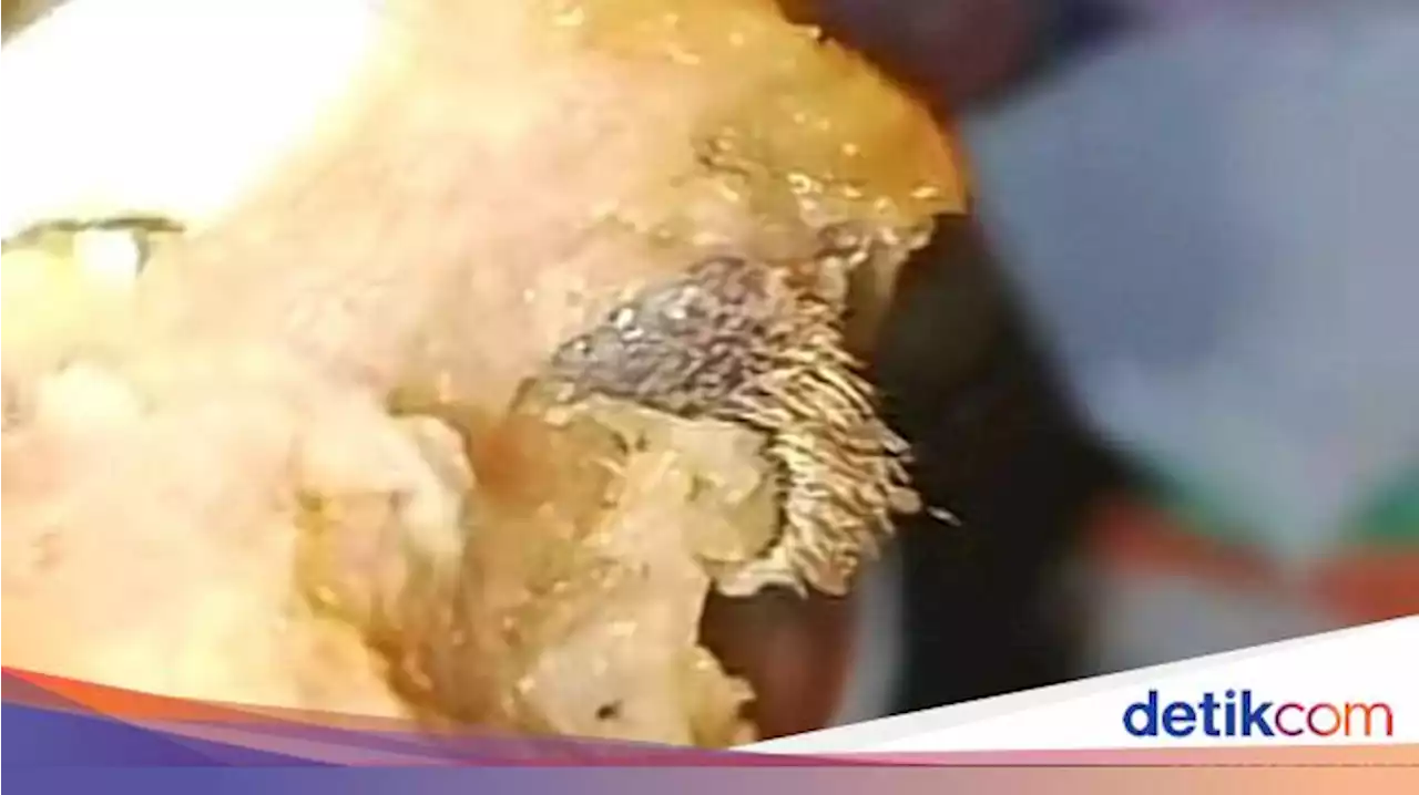 Polisi Periksa 2 Orang terkait Siomay Isi Kulit Tikus di Morowali Sulteng