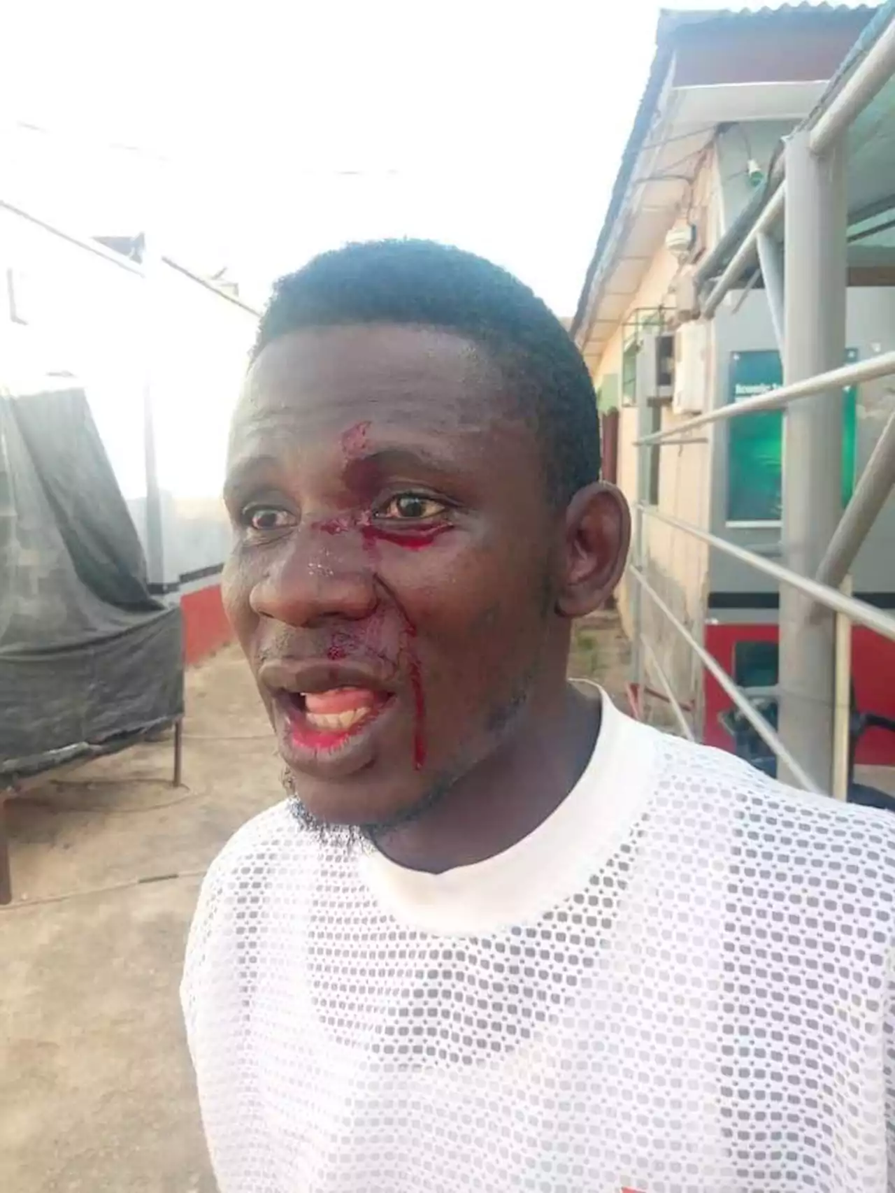 Former Ogun Student Leader Cries Out Over Alleged Assault, Threat To Life By Governor Abiodun’s Aide | Sahara Reporters