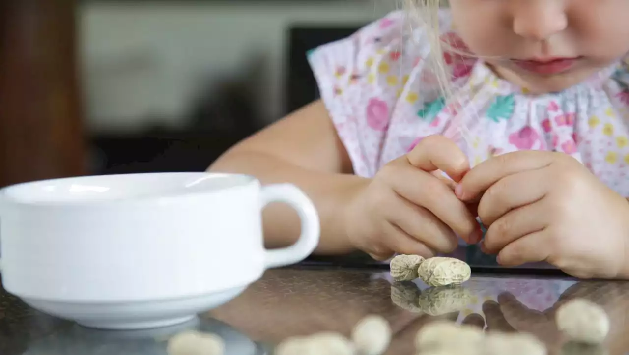 Allergie gegen Erdnüsse: Wie Pflaster schon Kindern helfen können