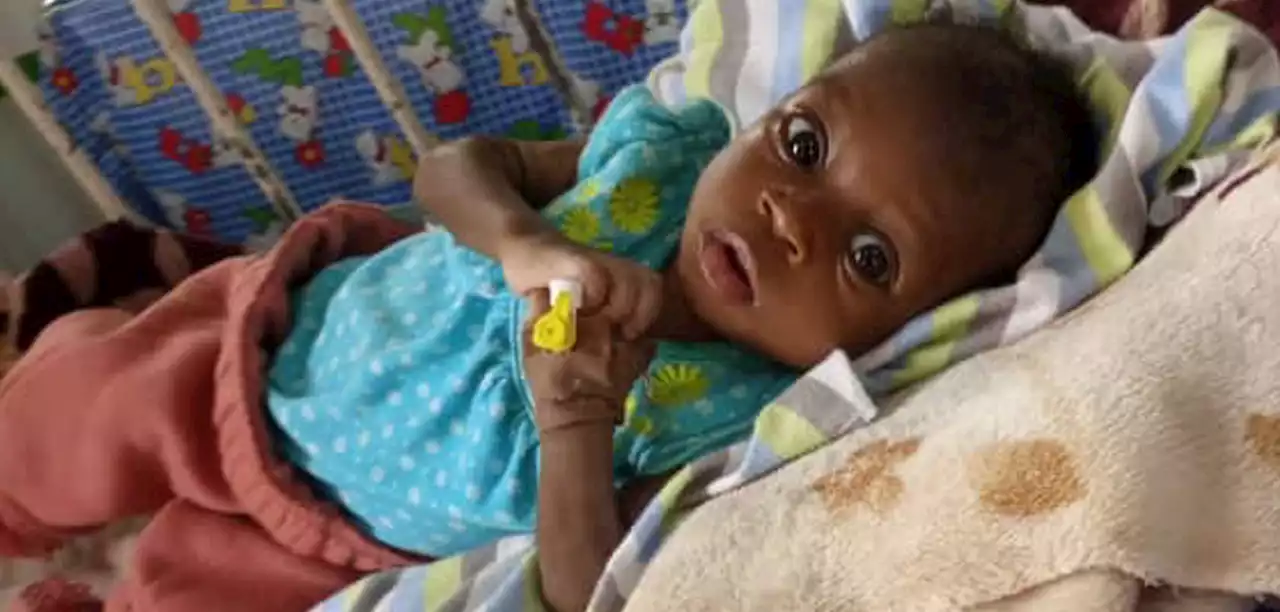 Baby with hole in heart needs N7m for surgery