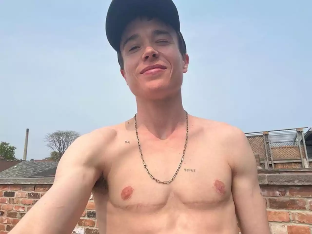 Elliot Page celebrates his ‘transjoy’ with topless snap showing surgery scars