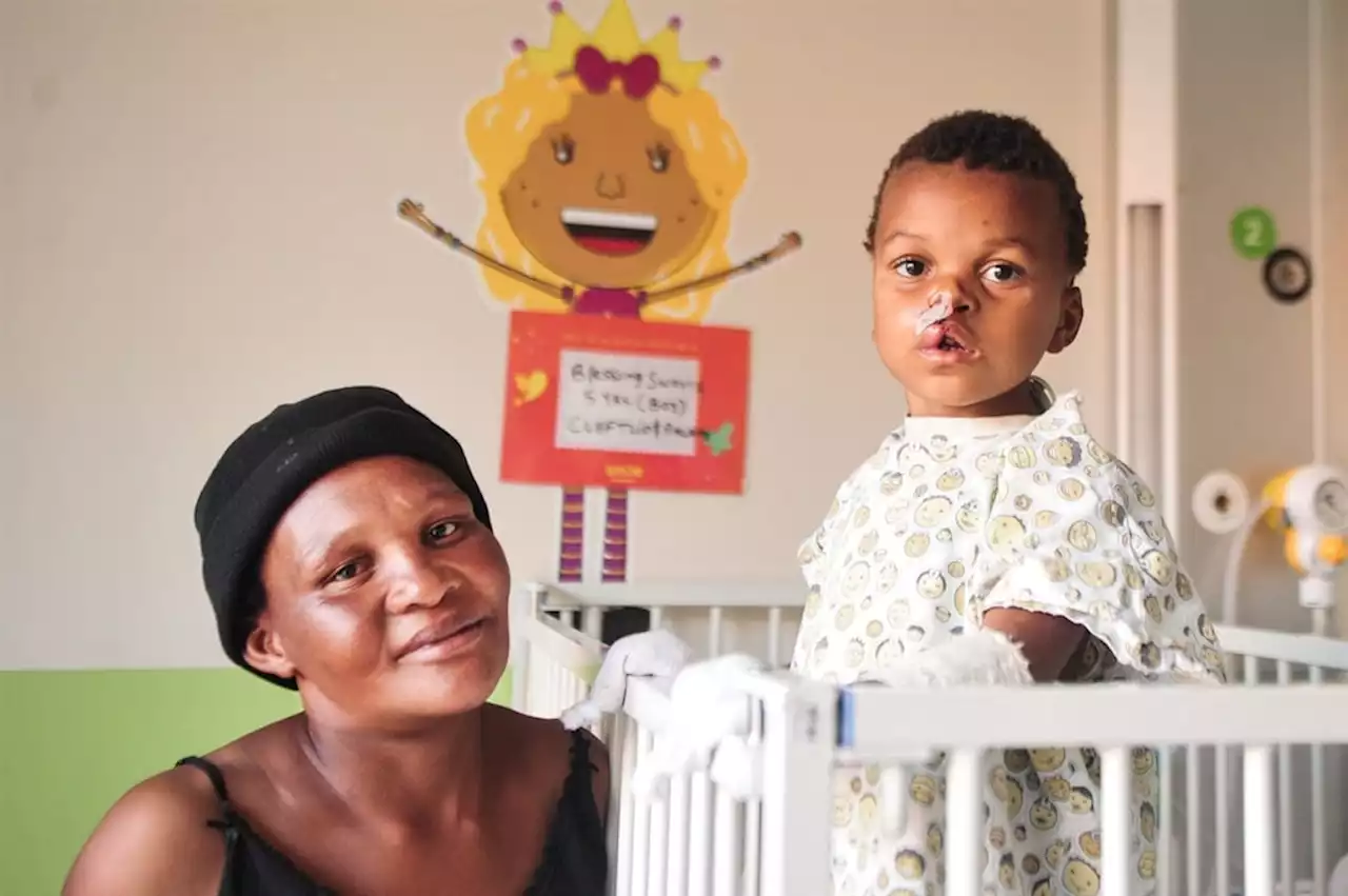 Smile Week wraps up with 22 successful reconstructive plastic surgeries | City Press