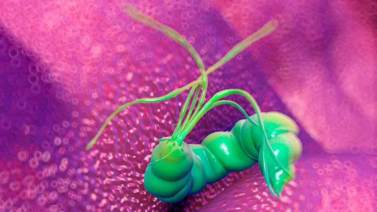 H Pylori Eradication Therapy Curbs Risk for Stomach Cancer