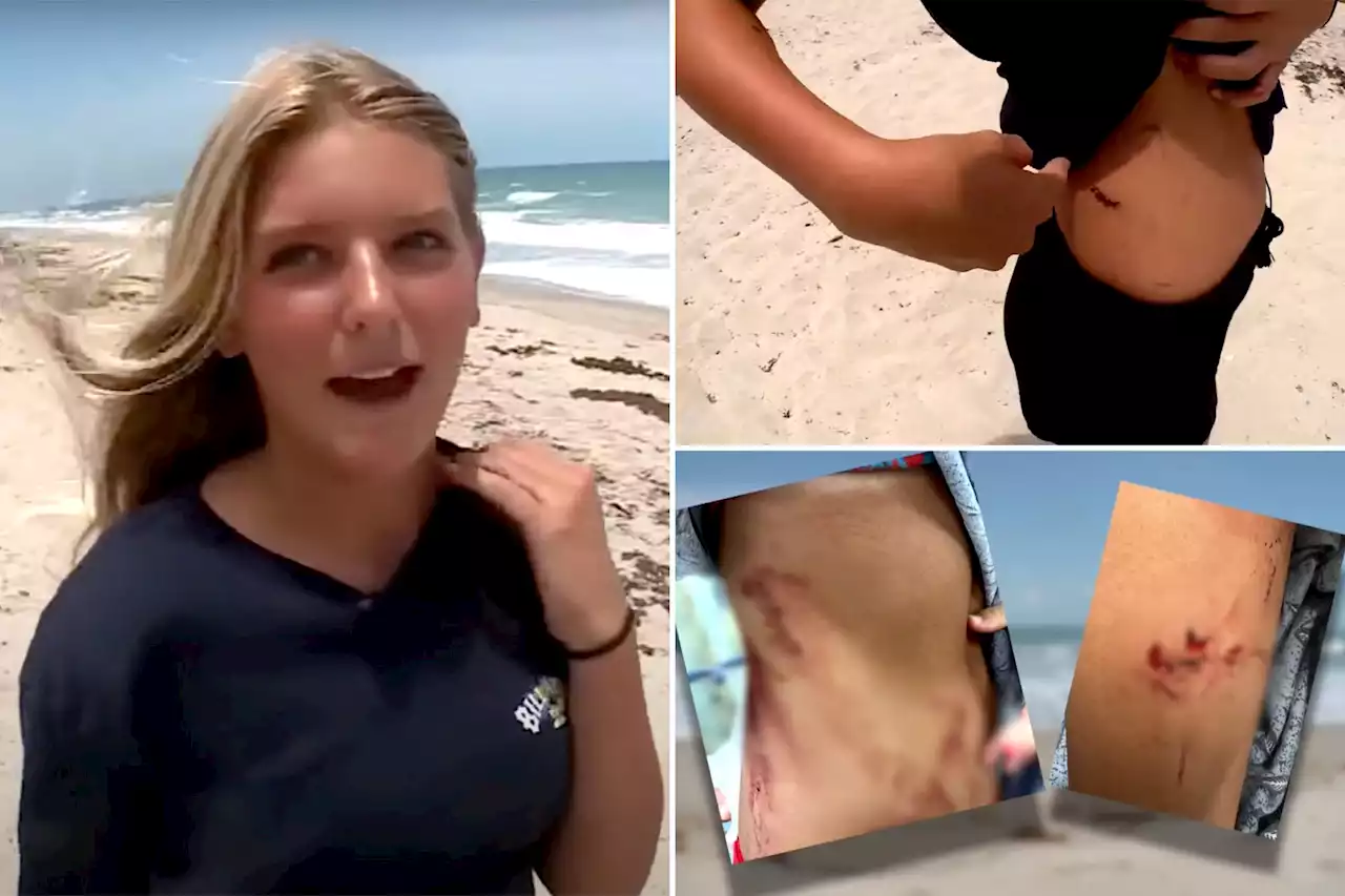 13-year-old girl fights off shark that attacked her at Florida beach