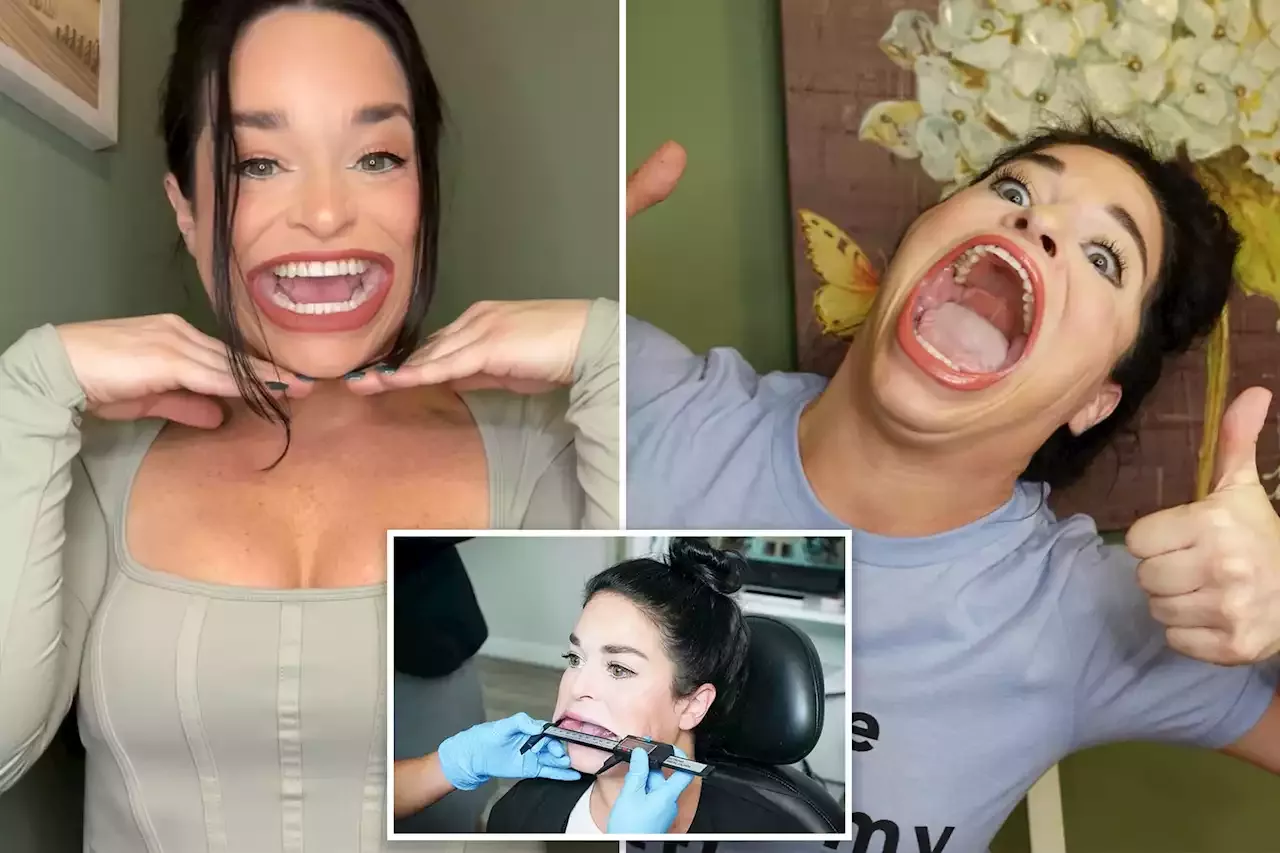 Samantha Ramsdell Woman With Worlds Largest Mouth Ignores Tiktok Hate To Make Serious Cash 3397