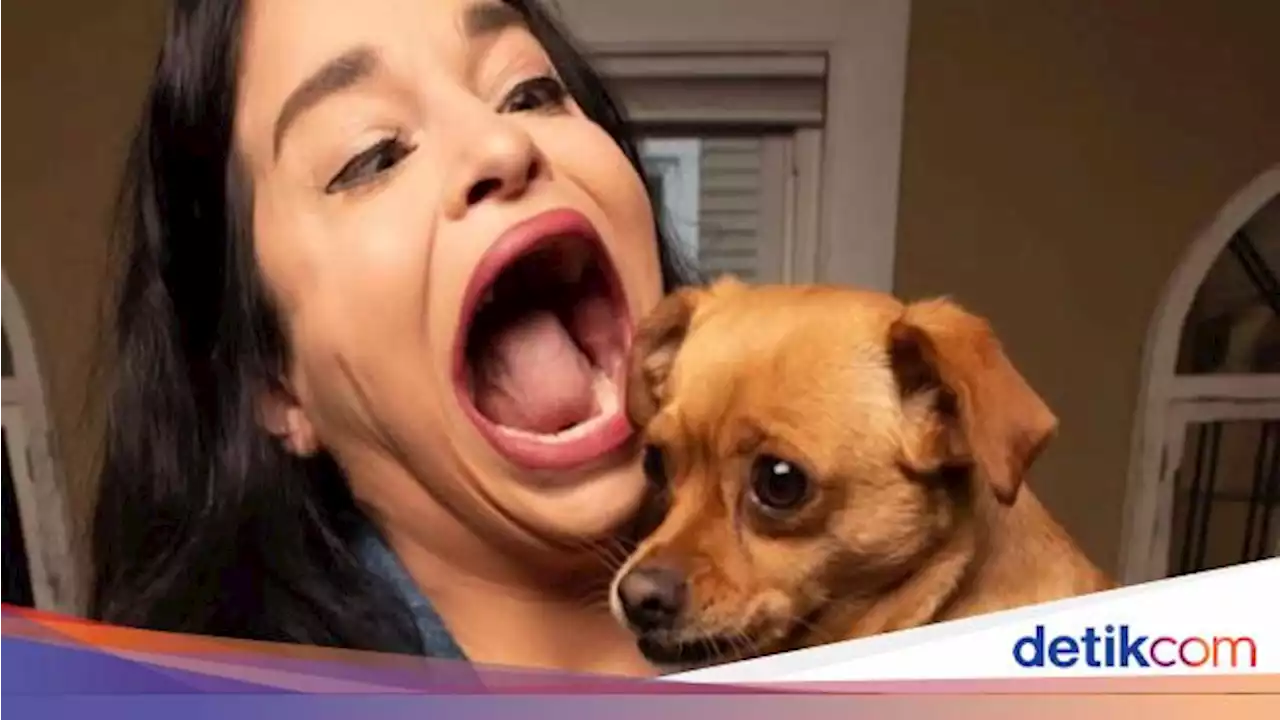 Kisah Wanita Cetak Rekor Mulut Terbesar di Dunia, Dikira Pakai Filter Medsos