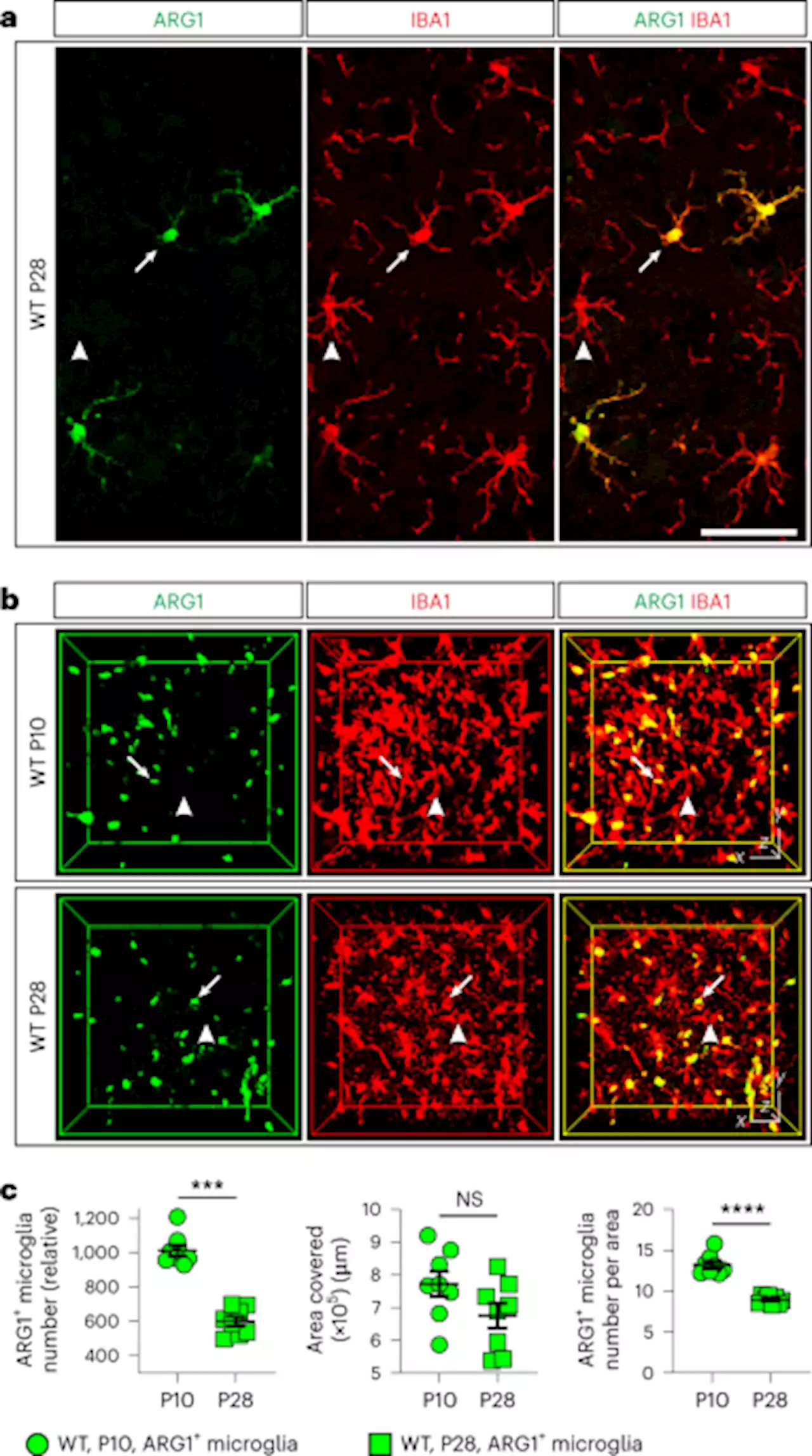 ARG1-expressing microglia show a distinct molecular signature and modulate postnatal development and function of the mouse brain - Nature Neuroscience