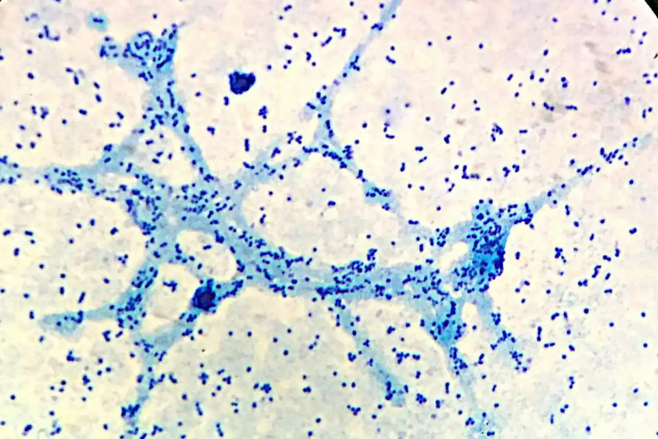 Novo teste pode indicar a progressão da Doença de Alzheimer