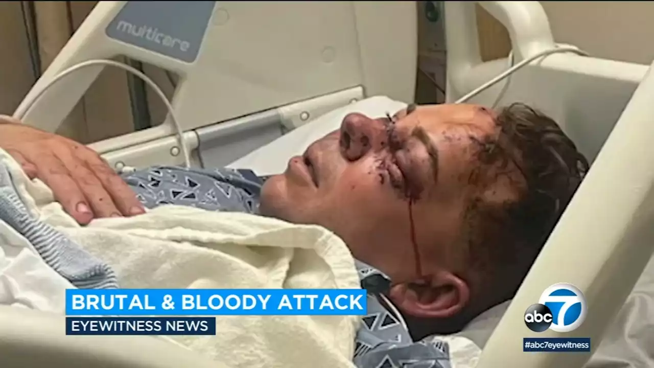 Store owner brutally beaten by armed robbers in attack caught on camera: 'They almost killed him'