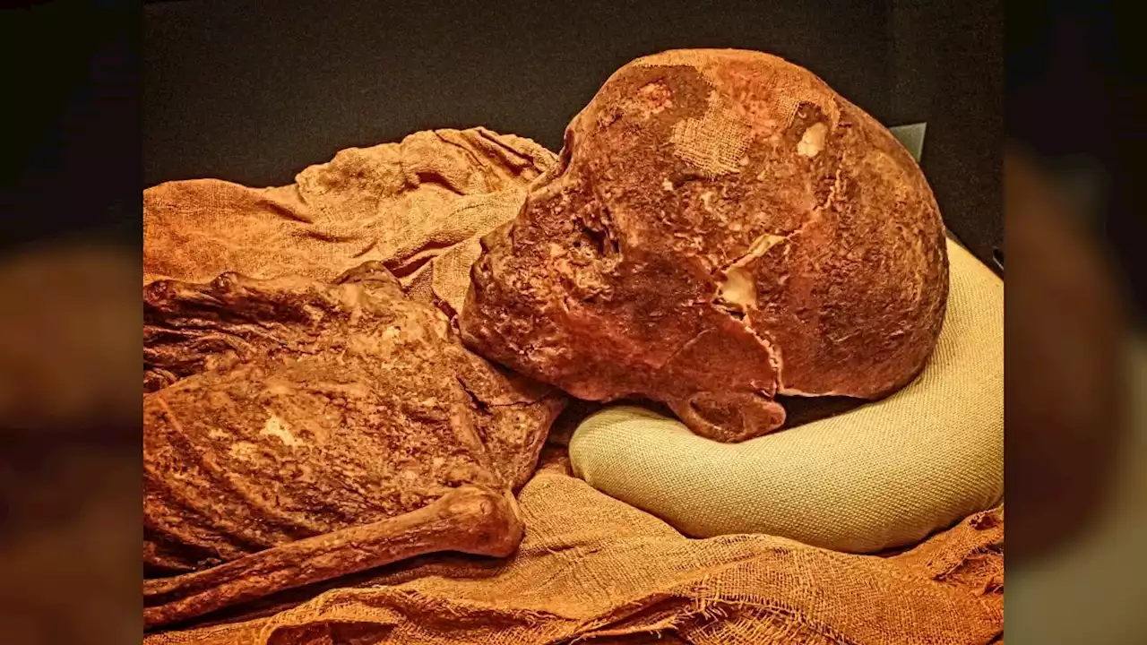 Ancient Egyptian children were plagued with blood disorders, mummies reveal