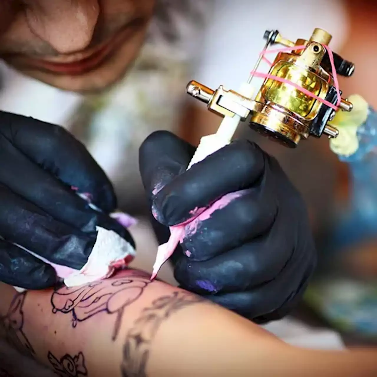 Slideshow: Tattoo Safety, and Safe Tattoo Removal