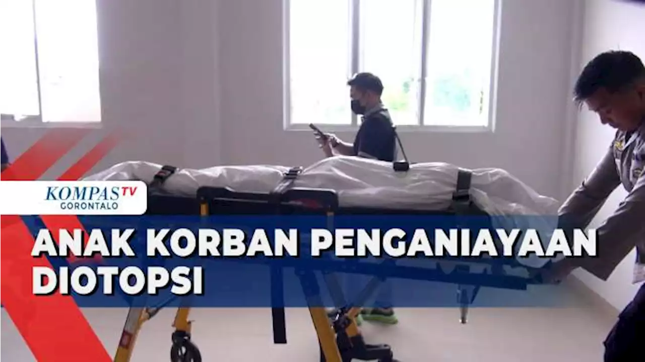 Anak yang Menjadi Korban Penganiayaan Bibinya Diotopsi di Rumah Sakit Bhayangkara