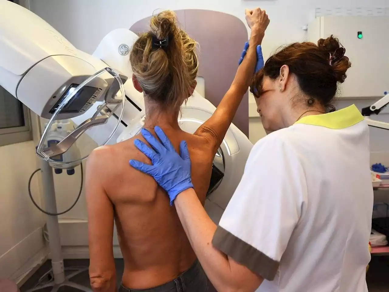 Christopher Labos: How soon is too soon for breast-cancer screening?