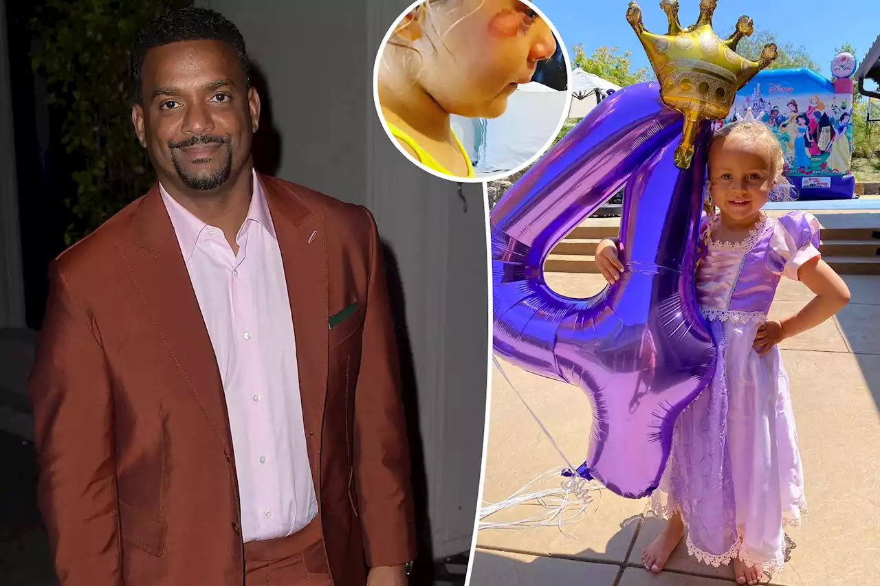 Alfonso Ribeiro’s daughter, 4, has long recovery after doctor ‘scalpels’ skin