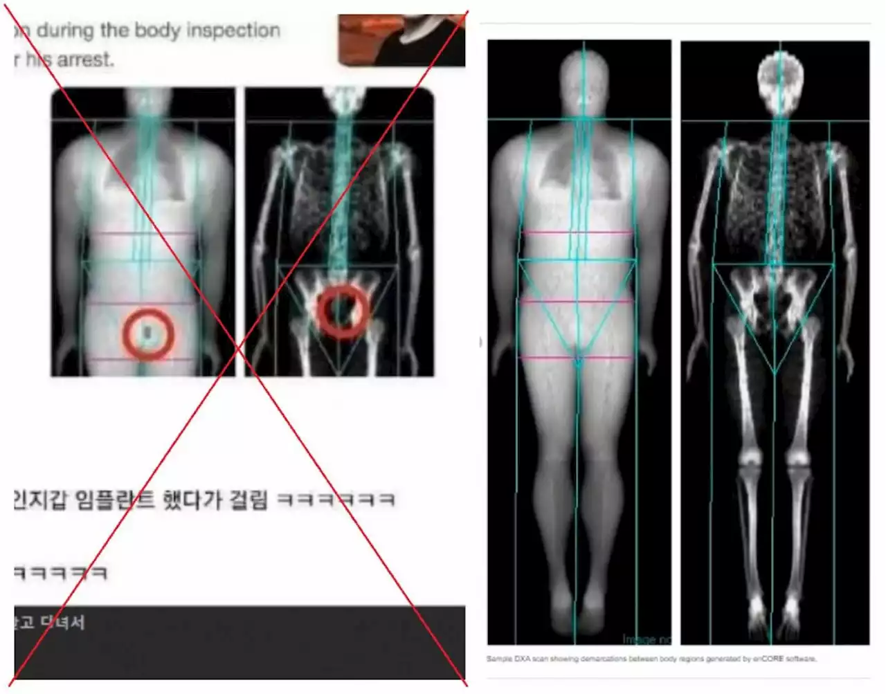 Old X-ray images lifted from satirical tweets about fugitive South Korean entrepreneur's arrest