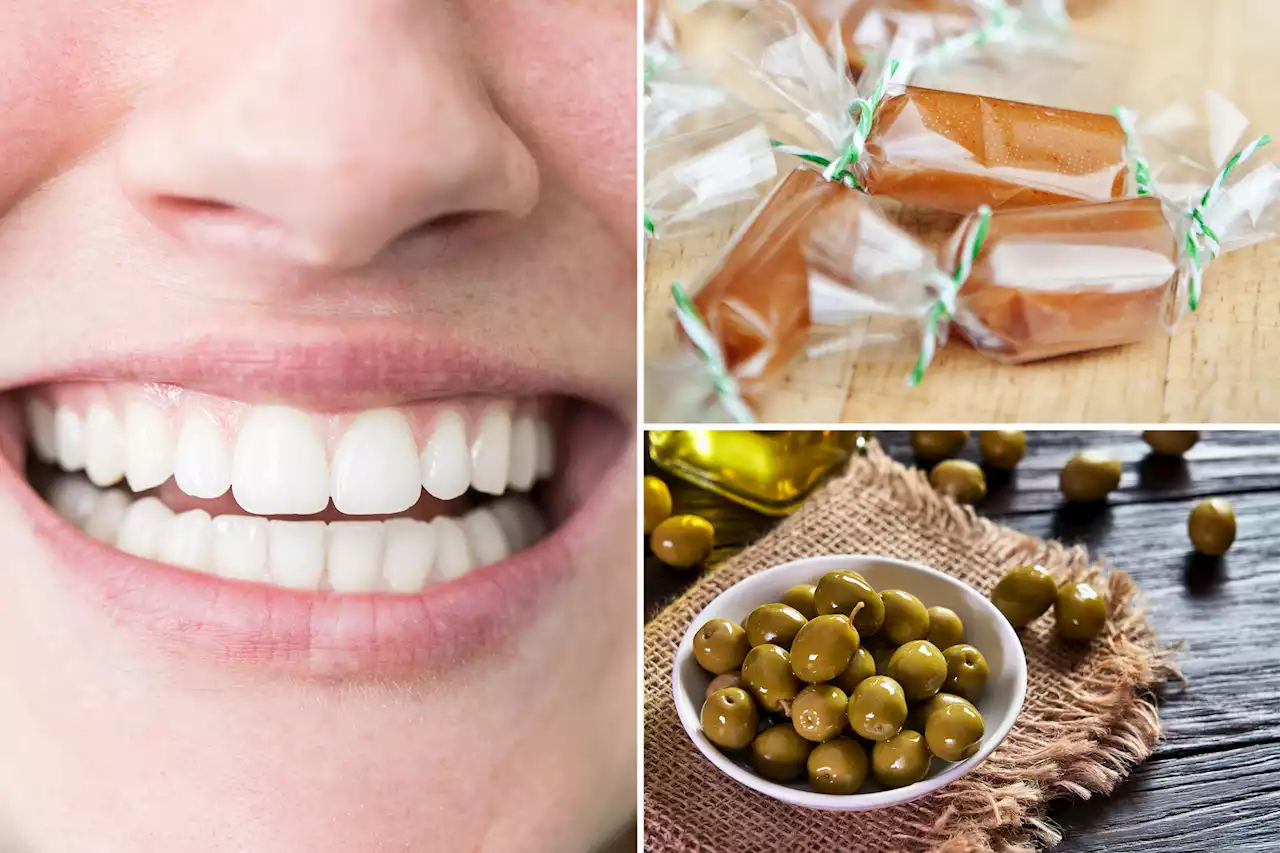 I’m a dentist — these 5 foods are awful for your teeth