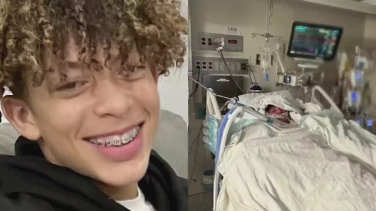 TikTok 'Flamethrower' challenge puts teen in hospital with burns to over 70% of his body