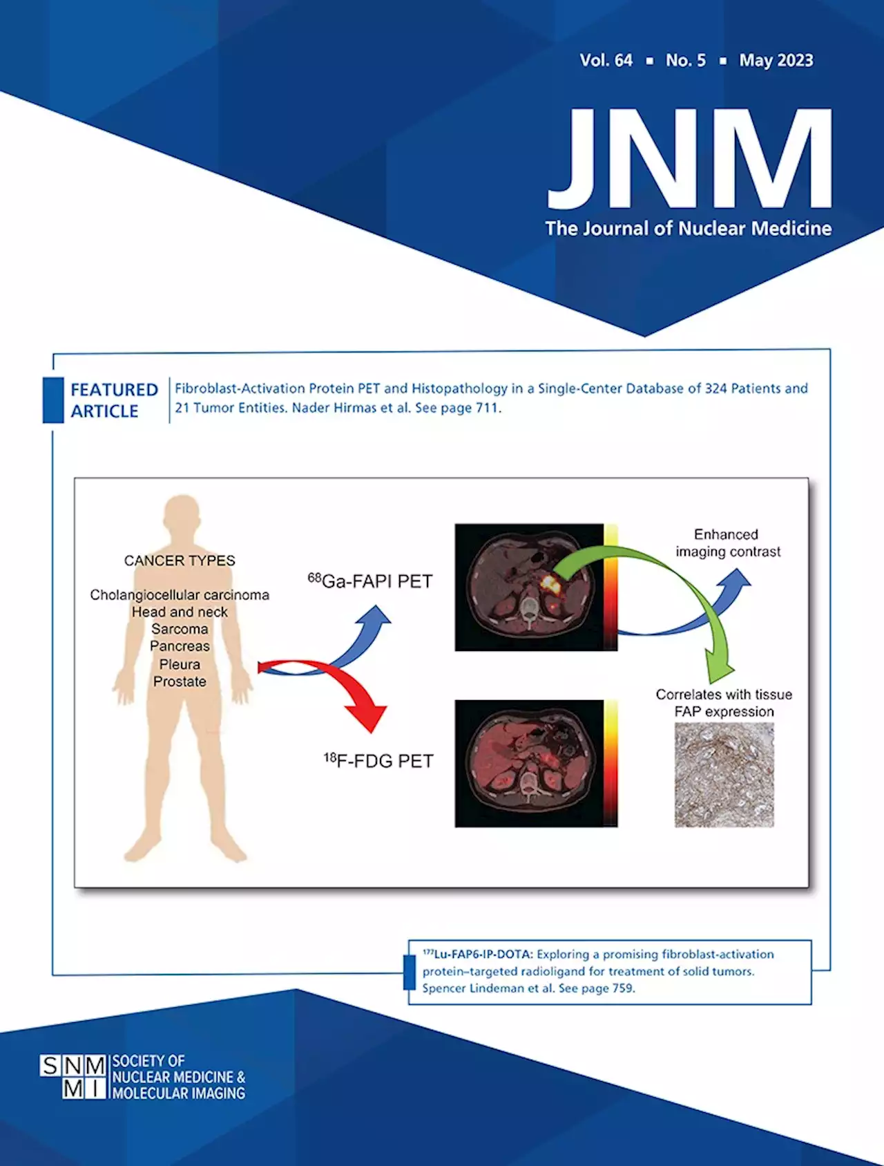 Fibroblast-Activation Protein PET and Histopathology in a Single-Center Database of 324 Patients and 21 Tumor Entities