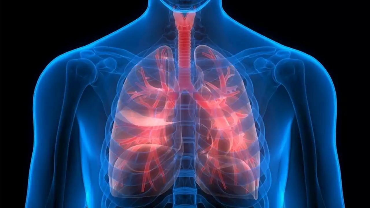 What is Bronchiolitis Obliterans Organizing Pneumonia?