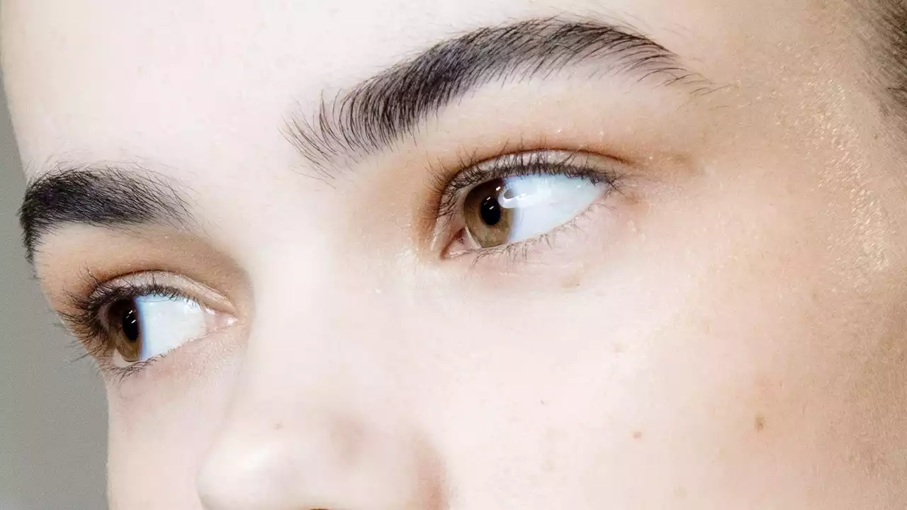 Under eye filler: what the experts want you to know before booking in