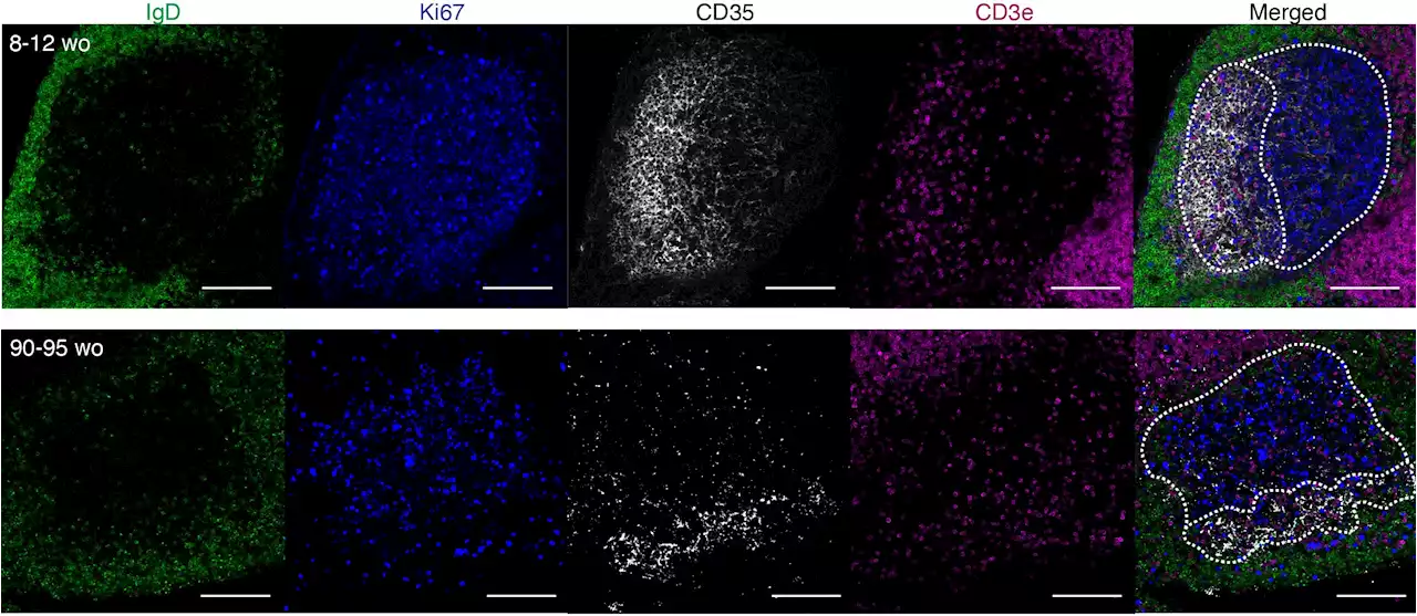 'Lost' immune cells partly to blame for reduced vaccine response in older people