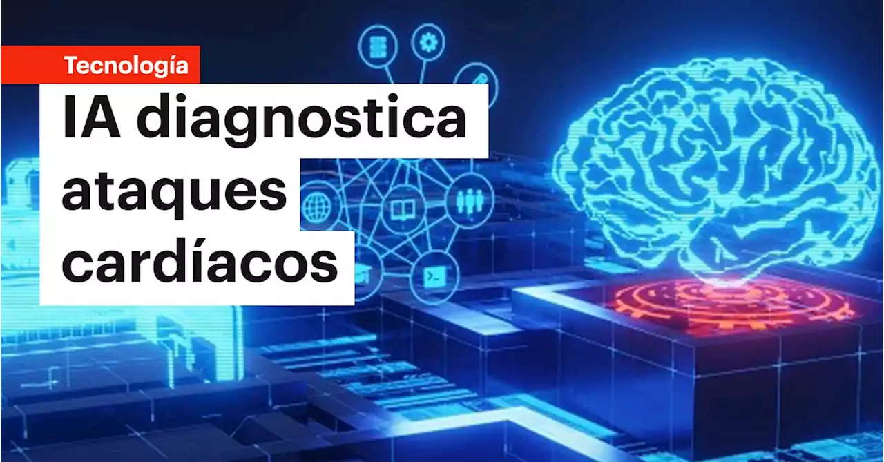 Desarrollan inteligencia artificial capaz de diagnosticar ataques cardíacos