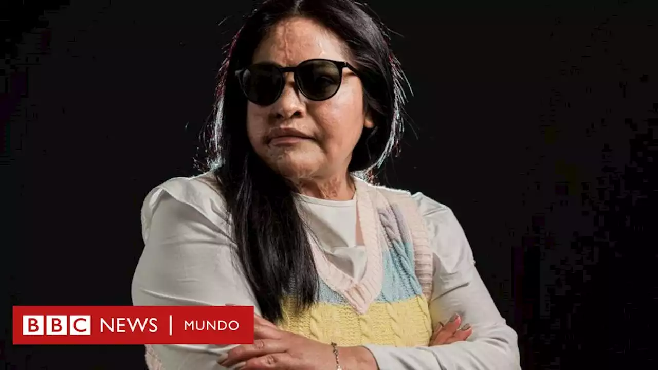 'Cuando condenaron a mi expareja, lo primero que recordé fue el ardor terrible de cuando me arrojó el ácido y sentía que se comía mi piel' - BBC News Mundo